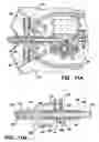 Fig. 11 - Infusion assembly that simultaneously delivers therapeutic fluid to plural body sites
