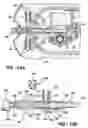 Fig. 12 - Infusion assembly that simultaneously delivers therapeutic fluid to plural body sites