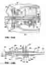 Fig. 13 - Infusion assembly that simultaneously delivers therapeutic fluid to plural body sites