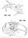 Fig. 14 - Infusion assembly that simultaneously delivers therapeutic fluid to plural body sites