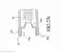Fig. 30 - Hypodermic syringe needle assembly