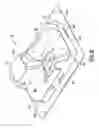 Fig. 07 - Prepackaged medical device and packaging tray