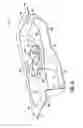 Fig. 11 - Prepackaged medical device and packaging tray