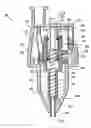 Fig. 01 - Pneumoperitoneum needle
