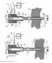 Fig. 05 - Pneumoperitoneum needle
