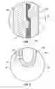 Fig. 06 - Pneumoperitoneum needle
