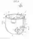Fig. 02 - Disposable pull-on wearing article