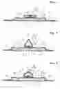 Fig. 04 - Sanitary napkin