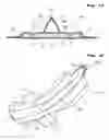 Fig. 11 - Sanitary napkin