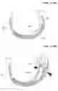 Fig. 13 - Sanitary napkin