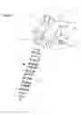 Fig. 03 - Osseous anchoring implant with a polyaxial head and method for installing the implant