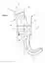 Fig. 05 - Osseous anchoring implant with a polyaxial head and method for installing the implant