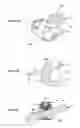 Fig. 06 - Osseous anchoring implant with a polyaxial head and method for installing the implant