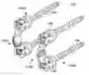 Fig. 01 - Vertebral facet stabilizer