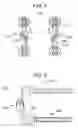 Fig. 04 - Vertebral facet stabilizer