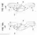 Fig. 09 - Vertebral facet stabilizer