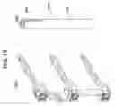Fig. 13 - Vertebral facet stabilizer