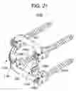 Fig. 15 - Vertebral facet stabilizer