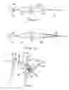 Fig. 05 - Methods and devices for endosonography-guided fundoplexy