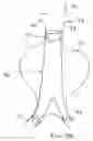Fig. 09 - Apparatus and methods for delivering sutures