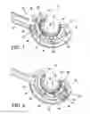 Fig. 03 - Endoscopic suturing device