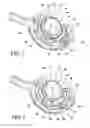 Fig. 05 - Endoscopic suturing device