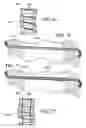 Fig. 30 - Surgical suturing apparatus with needle release system