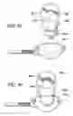 Fig. 35 - Surgical suturing apparatus with needle release system