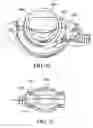 Fig. 37 - Surgical suturing apparatus with needle release system