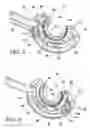 Fig. 03 - Adjustable vacuum chamber for a surgical suturing apparatus