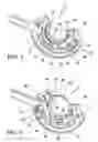 Fig. 04 - Adjustable vacuum chamber for a surgical suturing apparatus