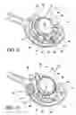 Fig. 06 - Adjustable vacuum chamber for a surgical suturing apparatus