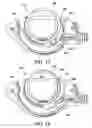 Fig. 08 - Adjustable vacuum chamber for a surgical suturing apparatus