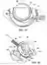 Fig. 10 - Adjustable vacuum chamber for a surgical suturing apparatus