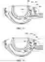 Fig. 15 - Adjustable vacuum chamber for a surgical suturing apparatus