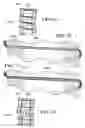 Fig. 30 - Adjustable vacuum chamber for a surgical suturing apparatus