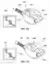 Fig. 33 - Adjustable vacuum chamber for a surgical suturing apparatus