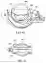 Fig. 37 - Adjustable vacuum chamber for a surgical suturing apparatus
