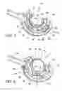 Fig. 04 - Surgical suturing apparatus with needle position indicator