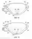 Fig. 11 - Surgical suturing apparatus with needle position indicator