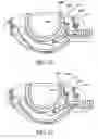 Fig. 15 - Surgical suturing apparatus with needle position indicator