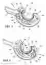 Fig. 03 - Surgical suturing apparatus with anti-backup system