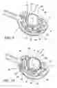 Fig. 06 - Surgical suturing apparatus with anti-backup system
