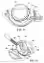Fig. 10 - Surgical suturing apparatus with anti-backup system