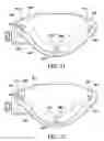 Fig. 11 - Surgical suturing apparatus with anti-backup system