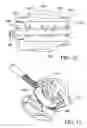 Fig. 14 - Surgical suturing apparatus with anti-backup system