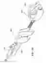 Fig. 27 - Surgical suturing apparatus with anti-backup system