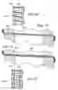Fig. 30 - Surgical suturing apparatus with anti-backup system