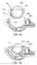 Fig. 34 - Surgical suturing apparatus with anti-backup system