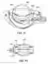 Fig. 37 - Surgical suturing apparatus with anti-backup system